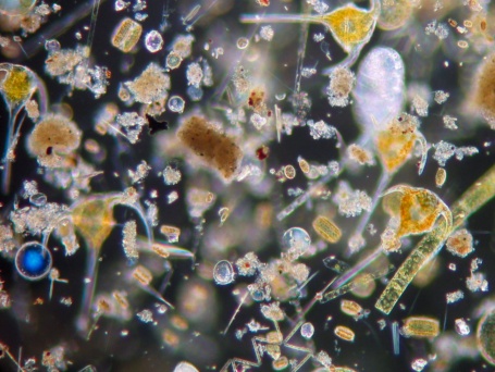 Mikroskopisch kleine Organismen in verschiedenen Farben und Formen. 