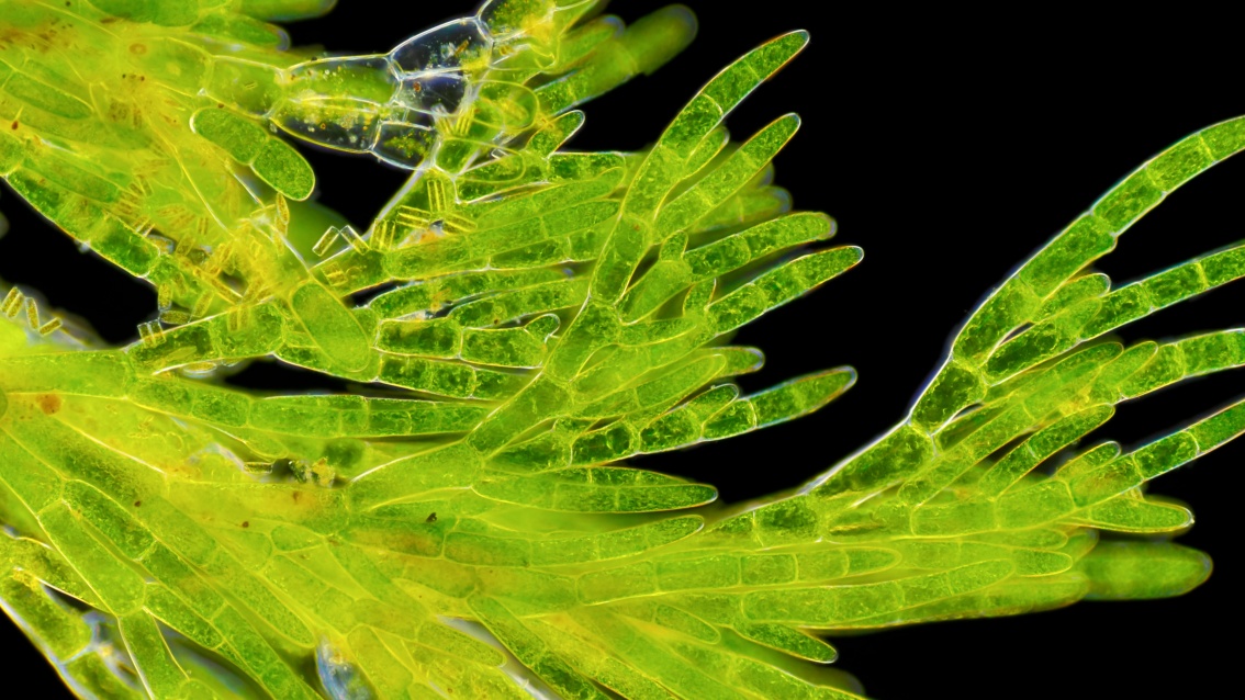 Aufgefächerte, transluzent-grüne Algen unter einem Mikroskop